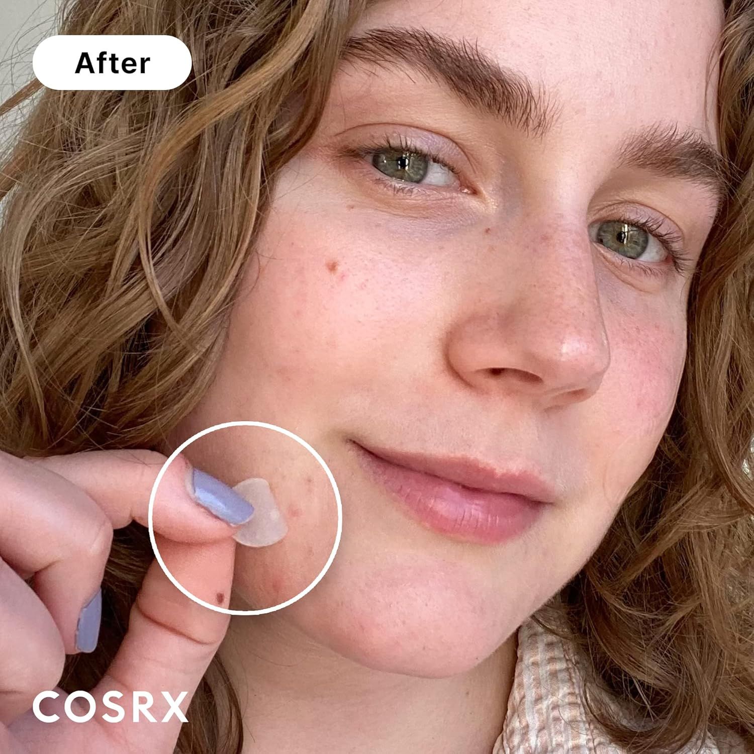 Demonstrates the visible improvement in skin texture and clarity after using the product, showing reduced blemishes and a more even complexion to prove product effectiveness.