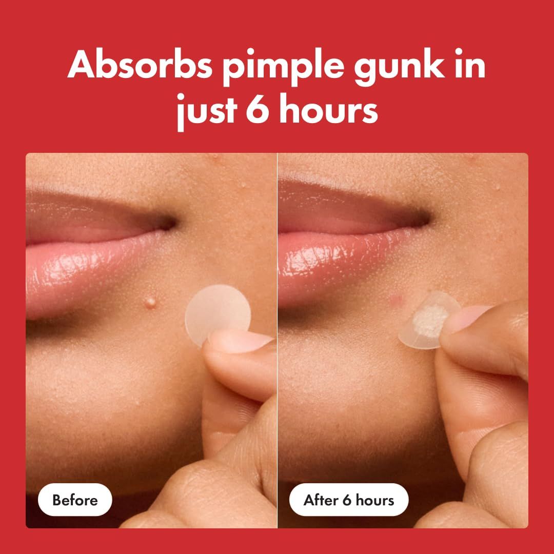 Demonstrates the product's effectiveness by showing visible reduction of a pimple in just 6 hours, proving fast results to reassure shoppers of its efficacy. Highlights the specific timeframe (6…