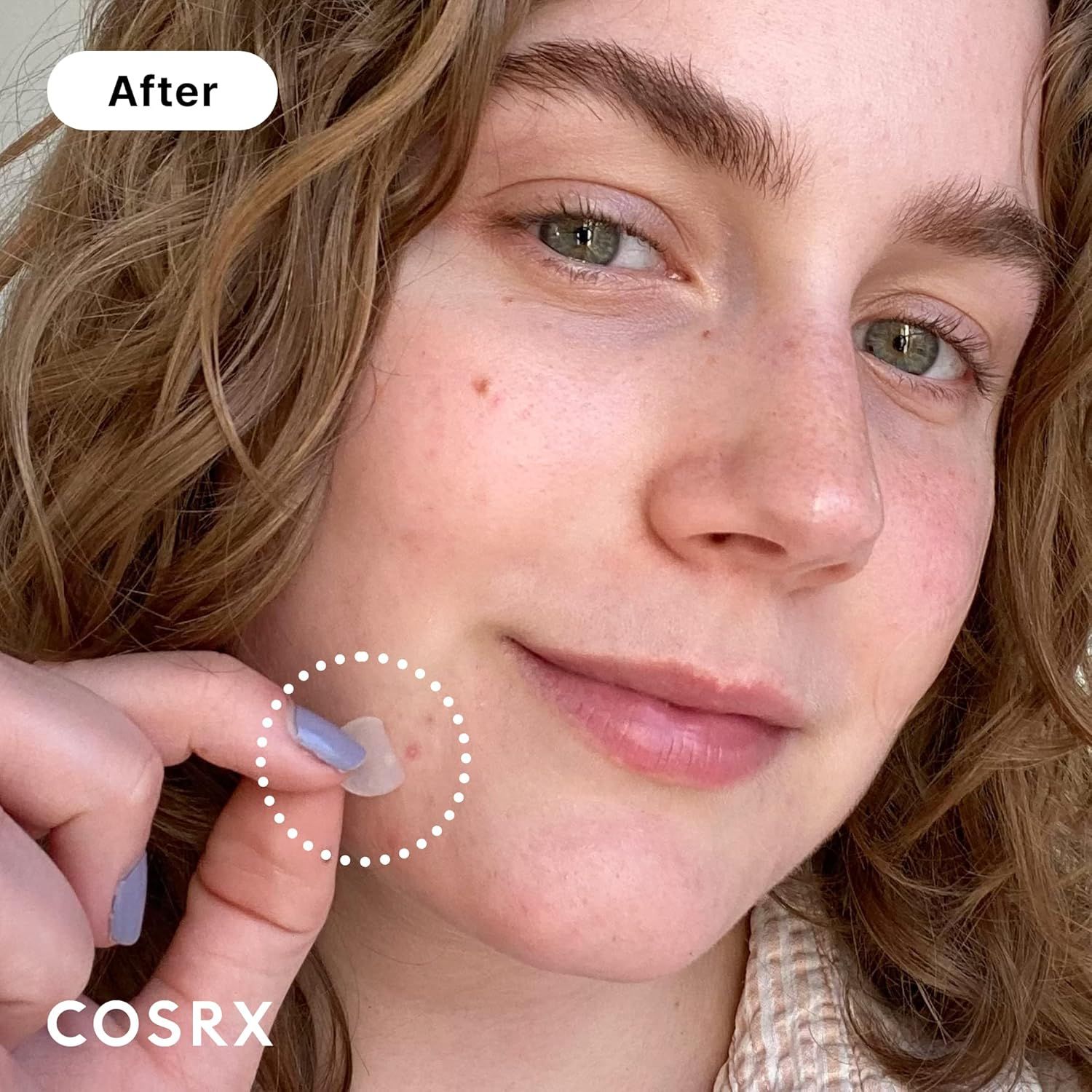 Demonstrates the visible transformation and effectiveness of the COSRX product in improving skin clarity and reducing blemishes, providing visual proof of results to build shopper confidence. Uses…