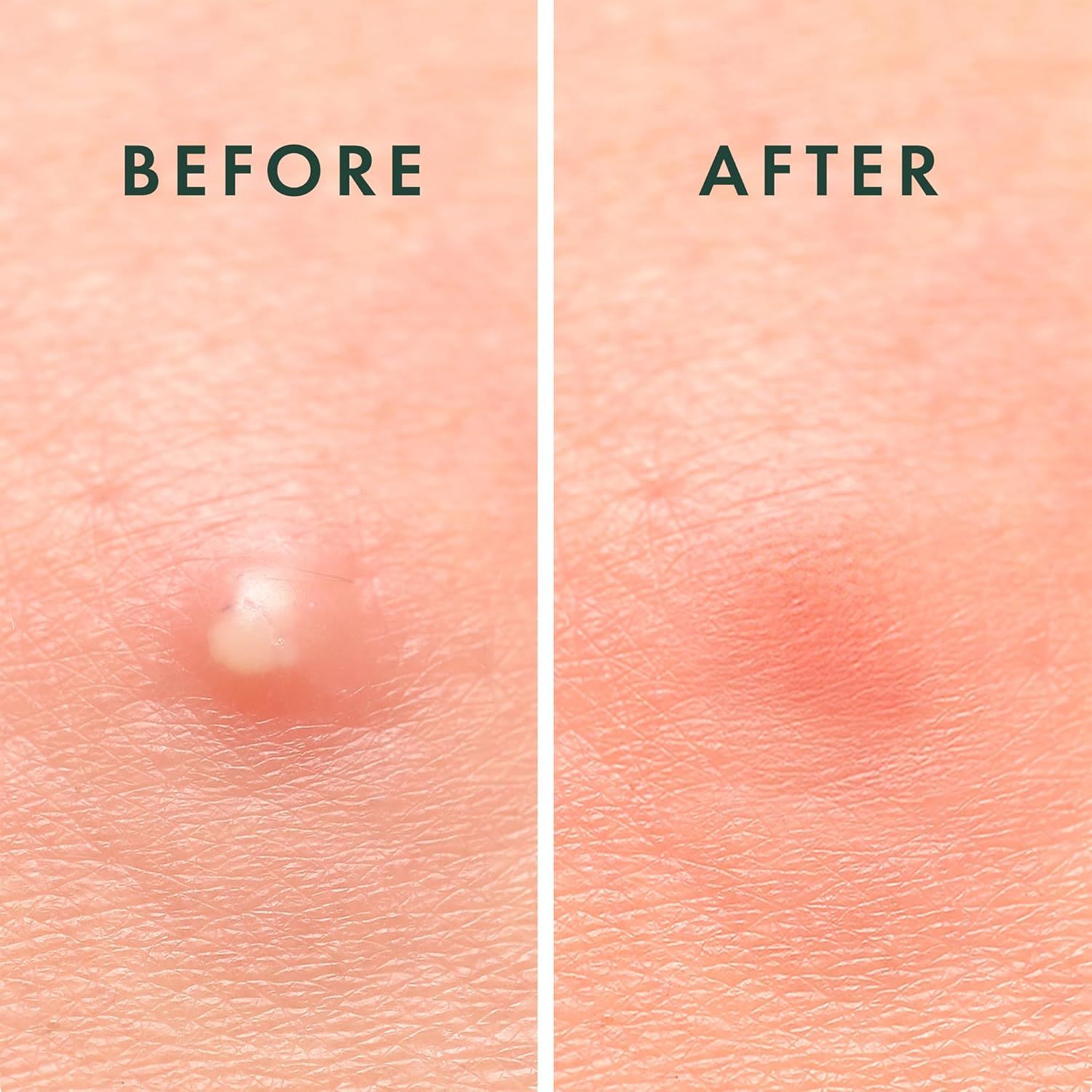 Demonstrates the product's effectiveness in removing skin blemishes and improving skin texture, providing visual proof of results to build shopper confidence.