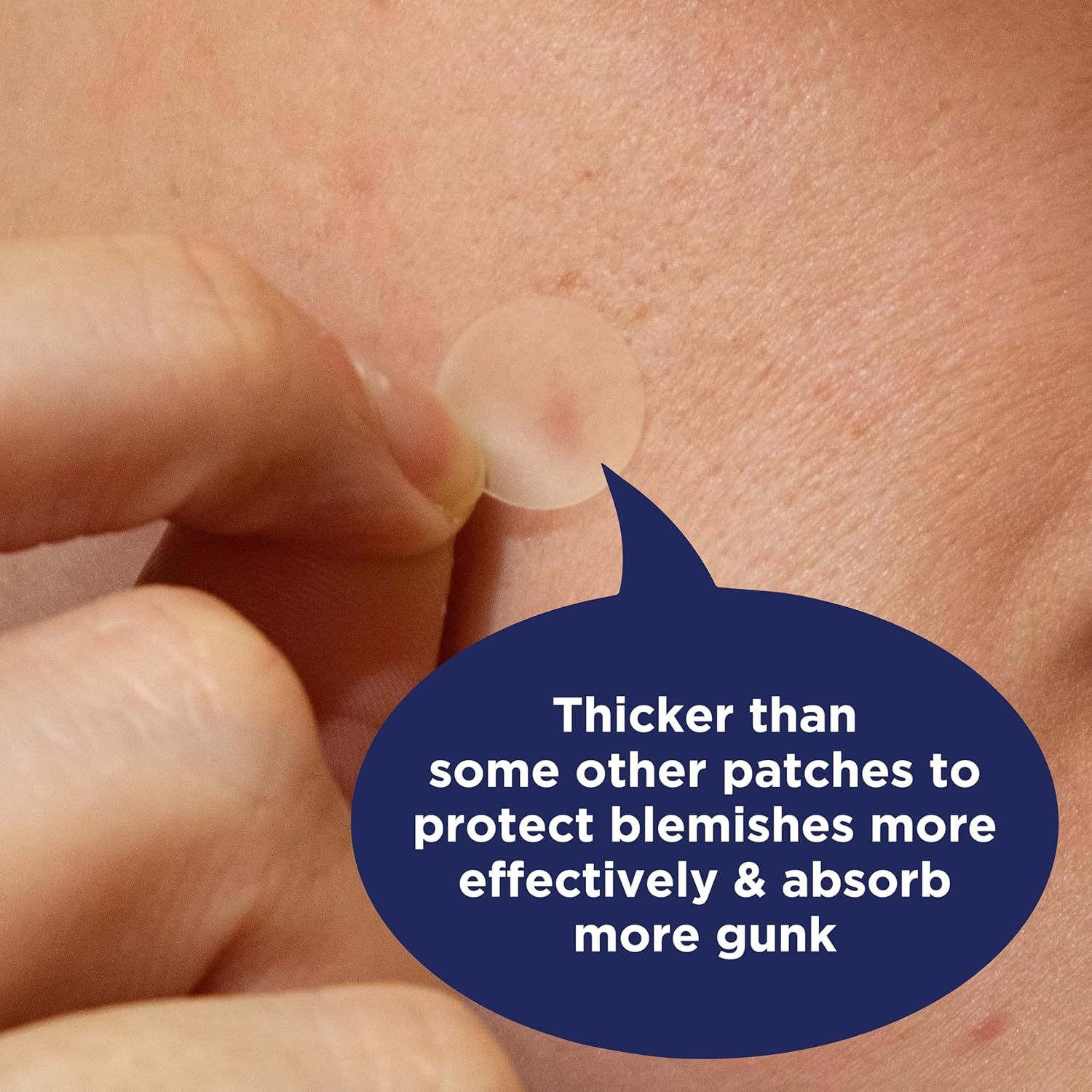 Communicates that this acne patch is thicker than competing patches, providing better protection and absorption of blemish fluid to reassure shoppers of its superior effectiveness. Highlights the…