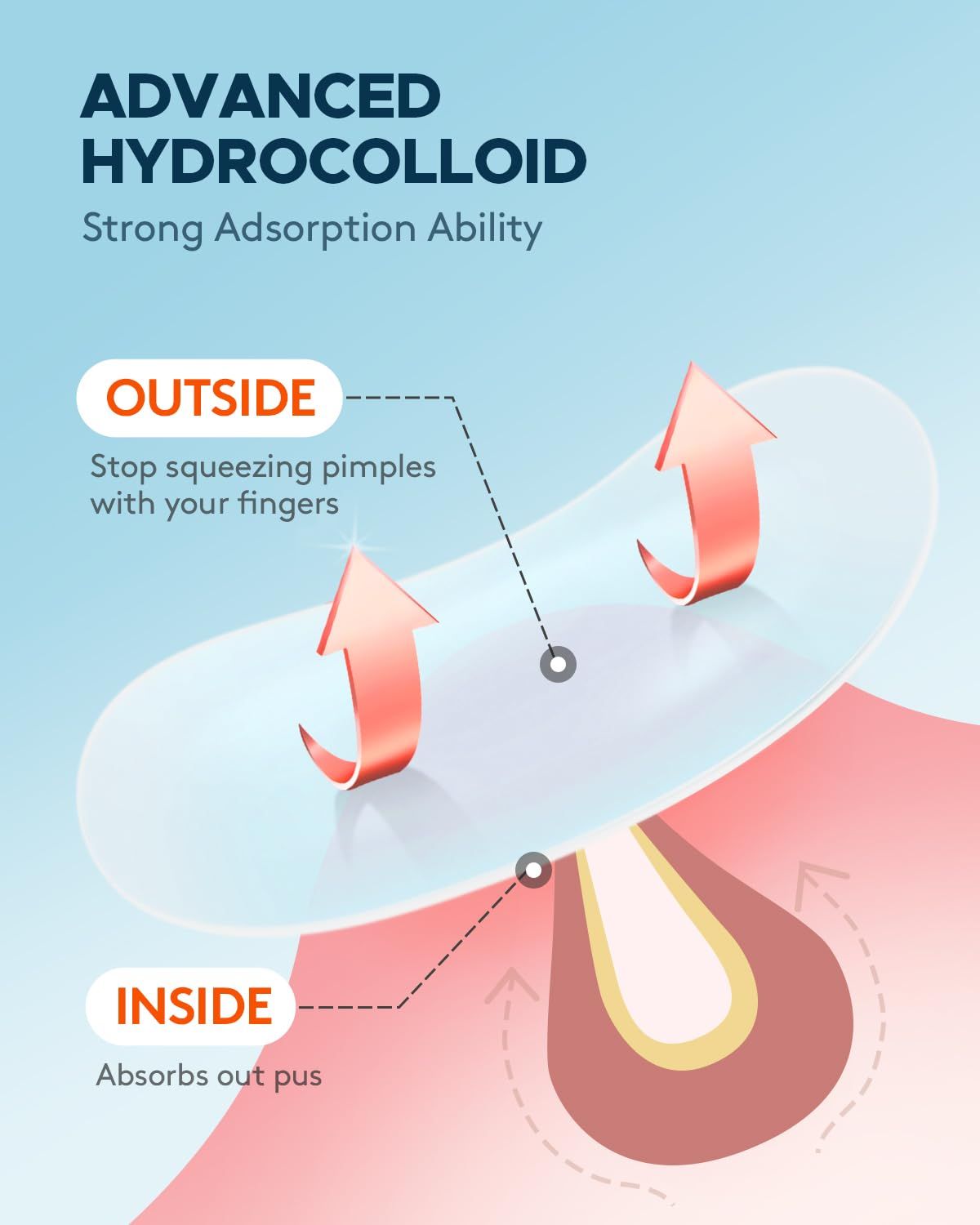 Educates shoppers on the correct way to use the product by showing that the hydrocolloid patch absorbs pus from inside the skin rather than requiring manual squeezing from outside, emphasizing…