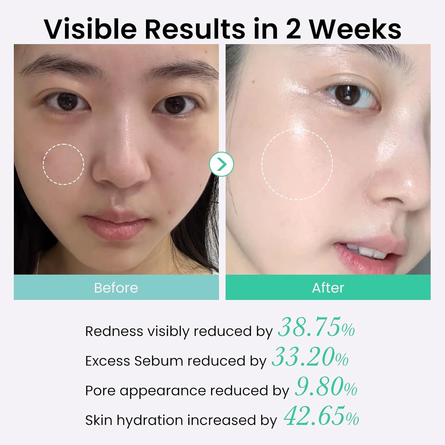 Demonstrates the transformative skincare results achieved in 2 weeks, showing visible improvements in redness, sebum, pores, and hydration to prove product effectiveness and build shopper…