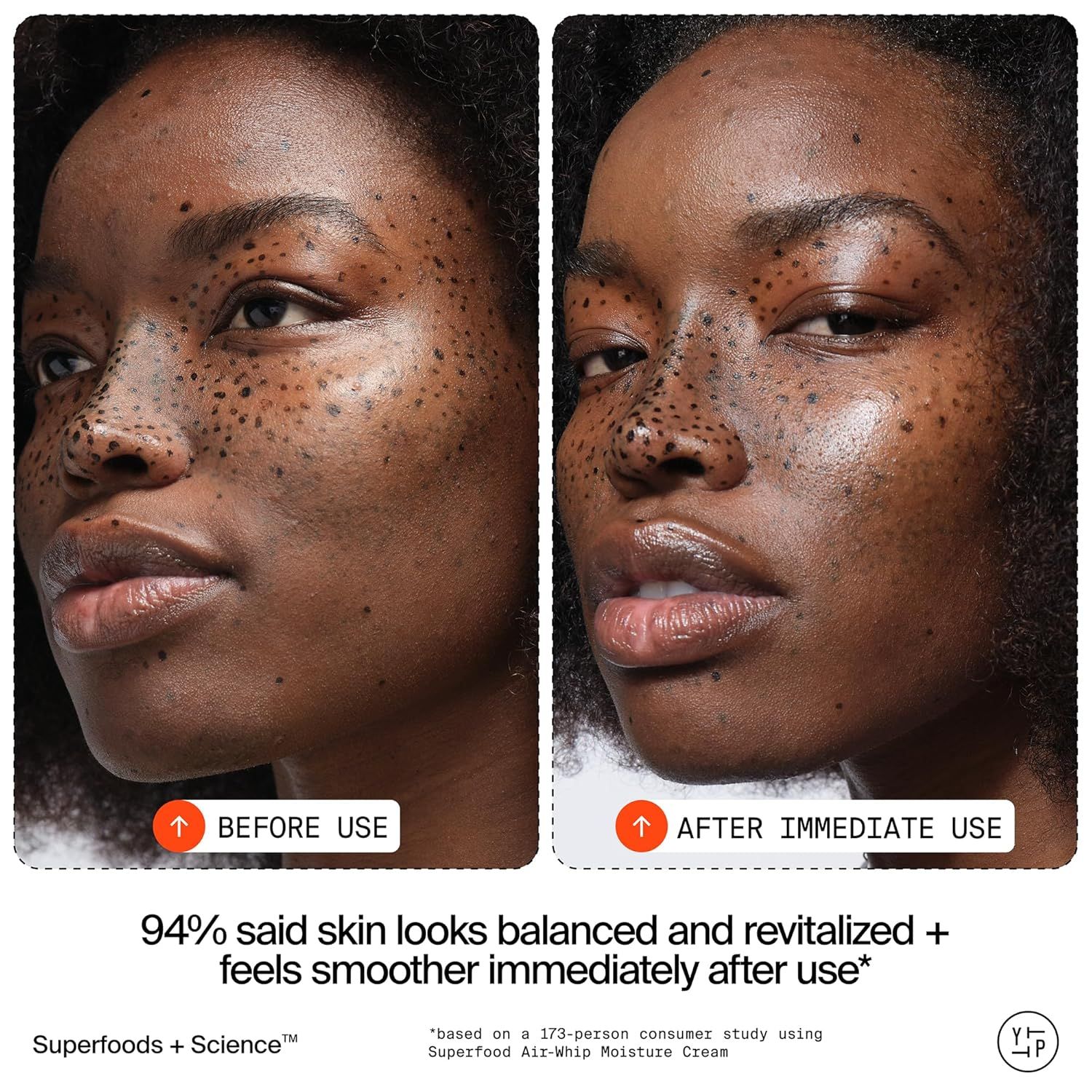 Demonstrates the immediate transformation and effectiveness of the skincare product by showing visible improvement in skin texture, smoothness, and overall appearance after use. Reinforces product…