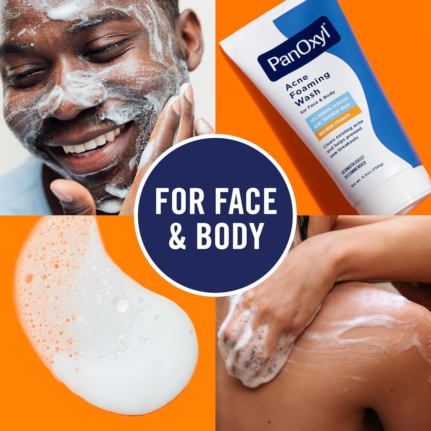 Demonstrates the product's versatility by showing it can be used on both face and body, appealing to shoppers looking for a multi-purpose acne treatment solution.