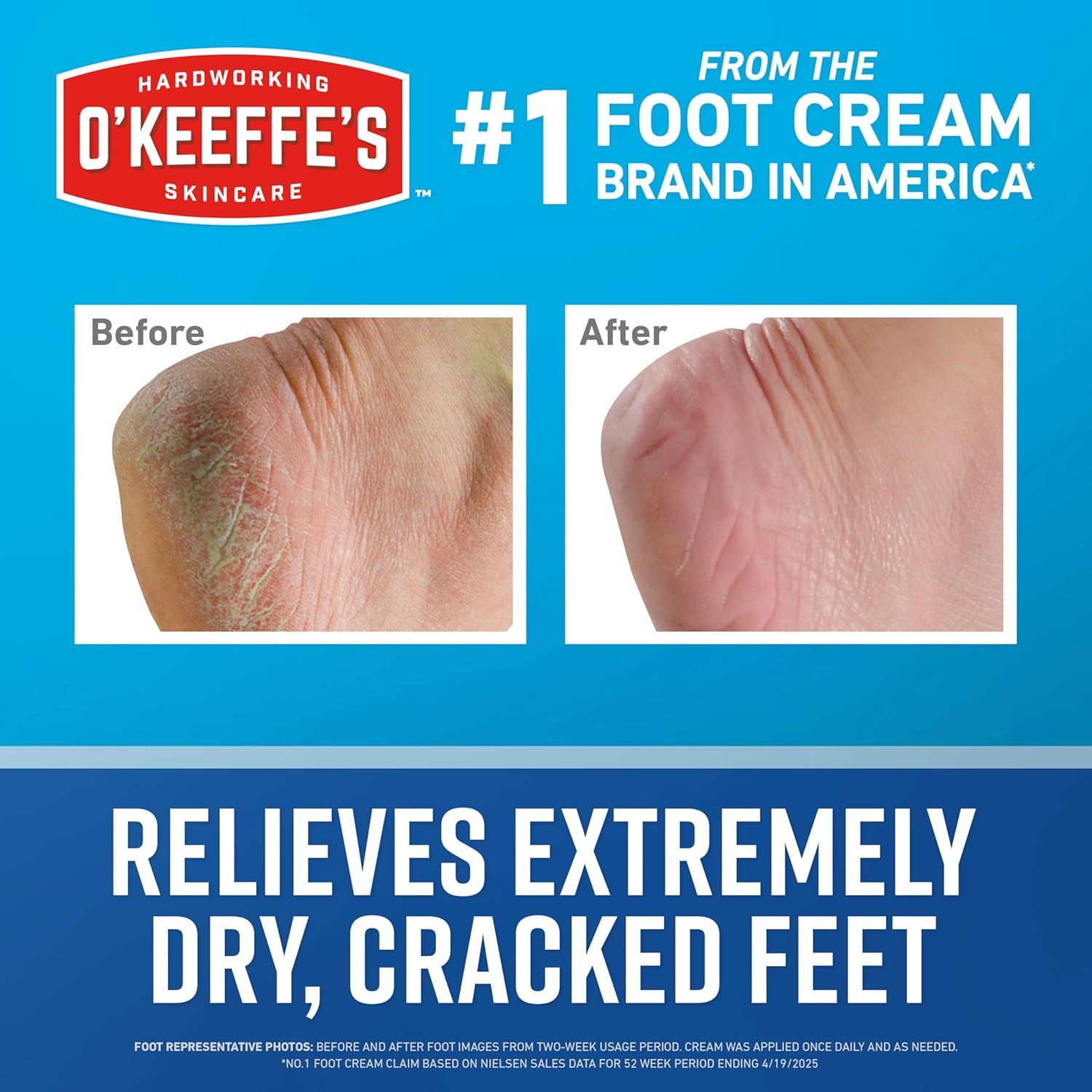 Demonstrates the product's effectiveness by showing a visual transformation from dry, cracked feet to smooth, healthy-looking skin after using O'Keeffe's foot cream. Establishes brand authority and…