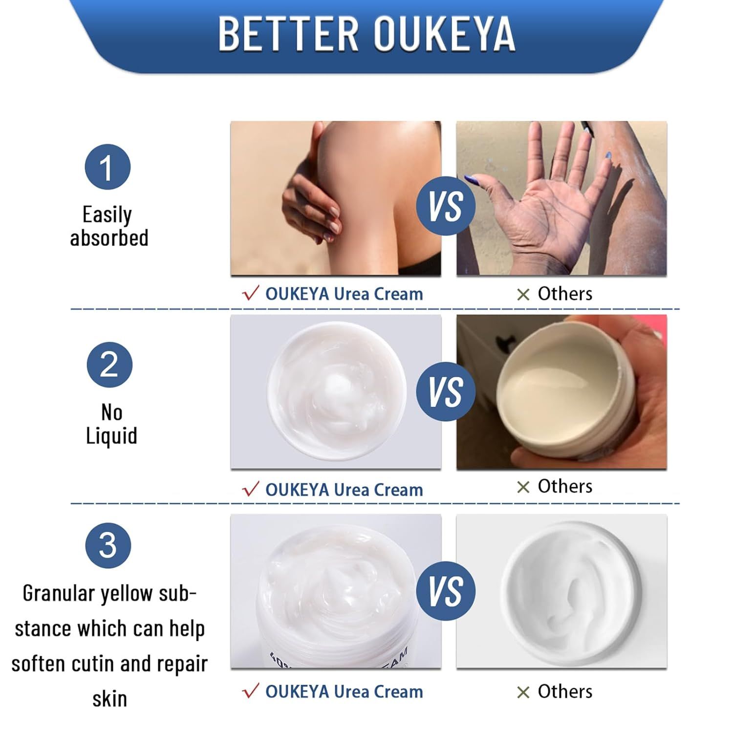This image demonstrates the superiority of OUKEYA Urea Cream over competing products by showing three key differentiators: better absorption, non-liquid consistency, and the presence of granular…