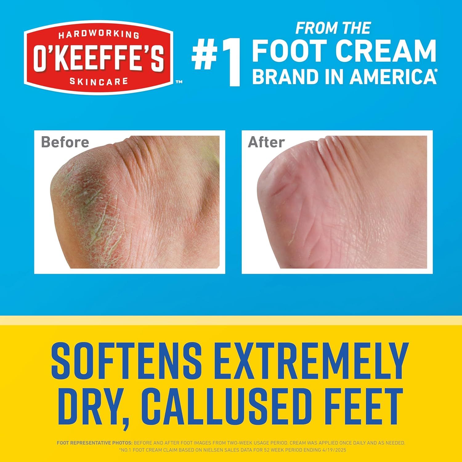 Demonstrates the product's effectiveness by showing a visual transformation of dry, callused feet to soft, smooth feet after using O'Keeffe's foot cream. Communicates the core benefit of the…