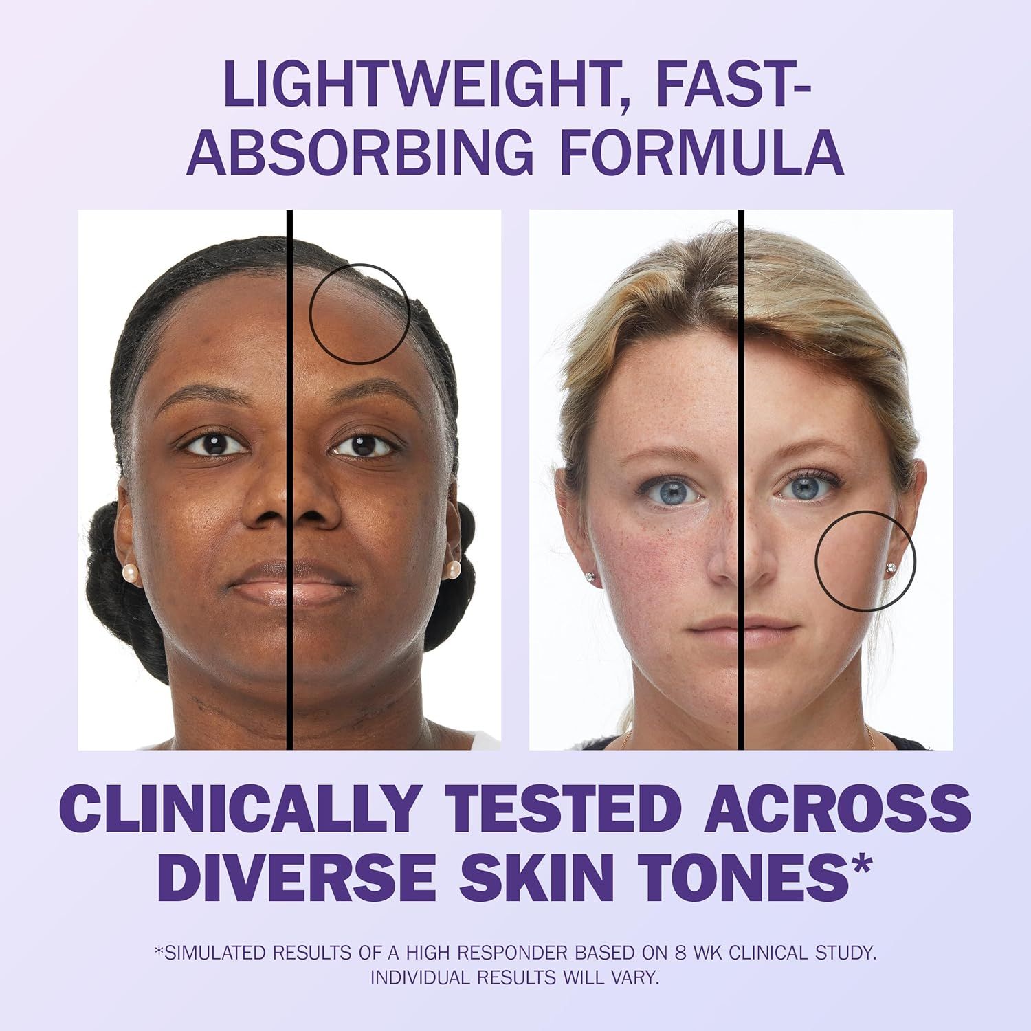 Demonstrates the visible transformation and effectiveness of the skincare product by showing before-and-after results on two different skin tones, reassuring shoppers that the product works across…