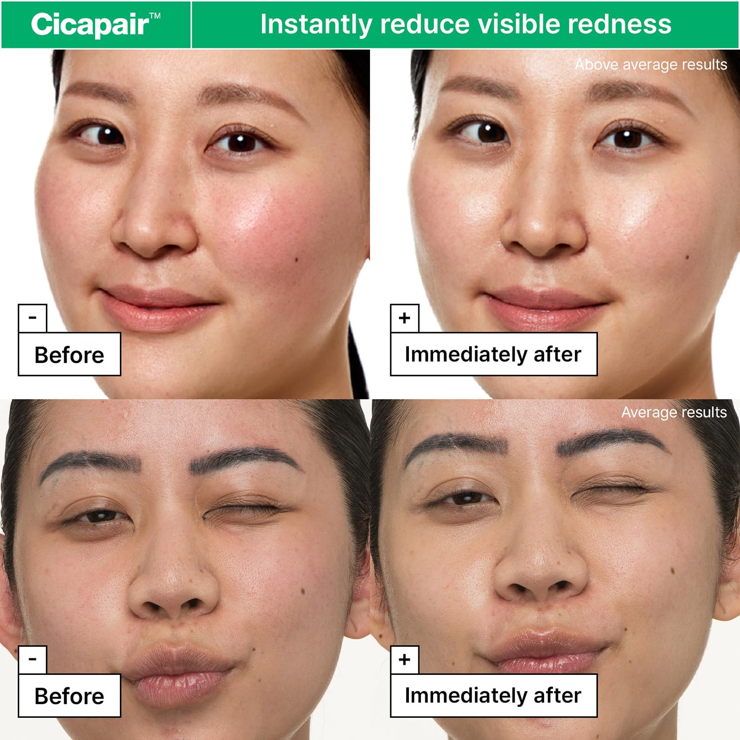 Amazon.com: Dr.Jart+ Cicapair Sensitive Skin Face Moisturizer for Redness and Barrier…: Infographics