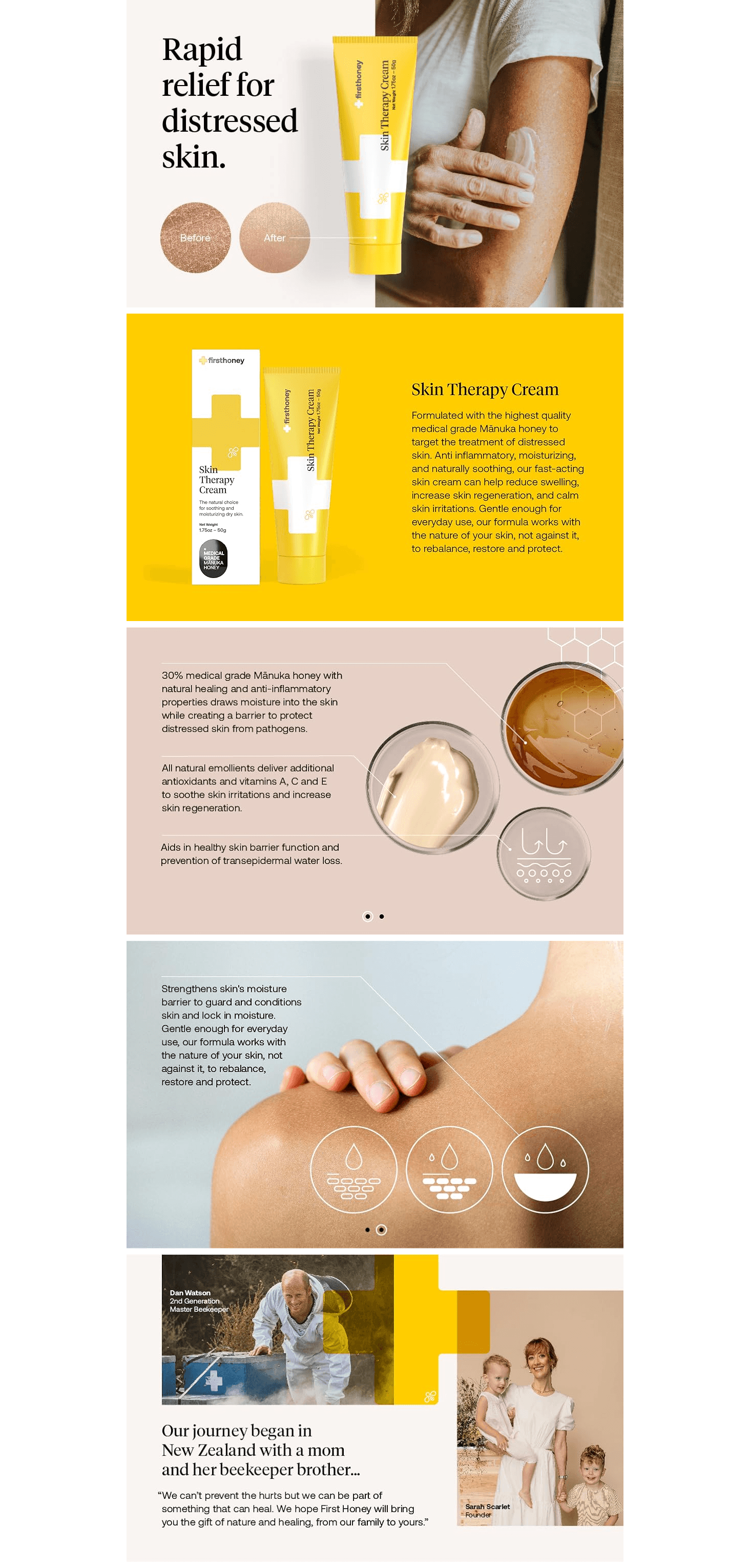 Amazon.com: First Honey® Manuka Honey Cream for Dry & Itchy Skin: A+ Premium